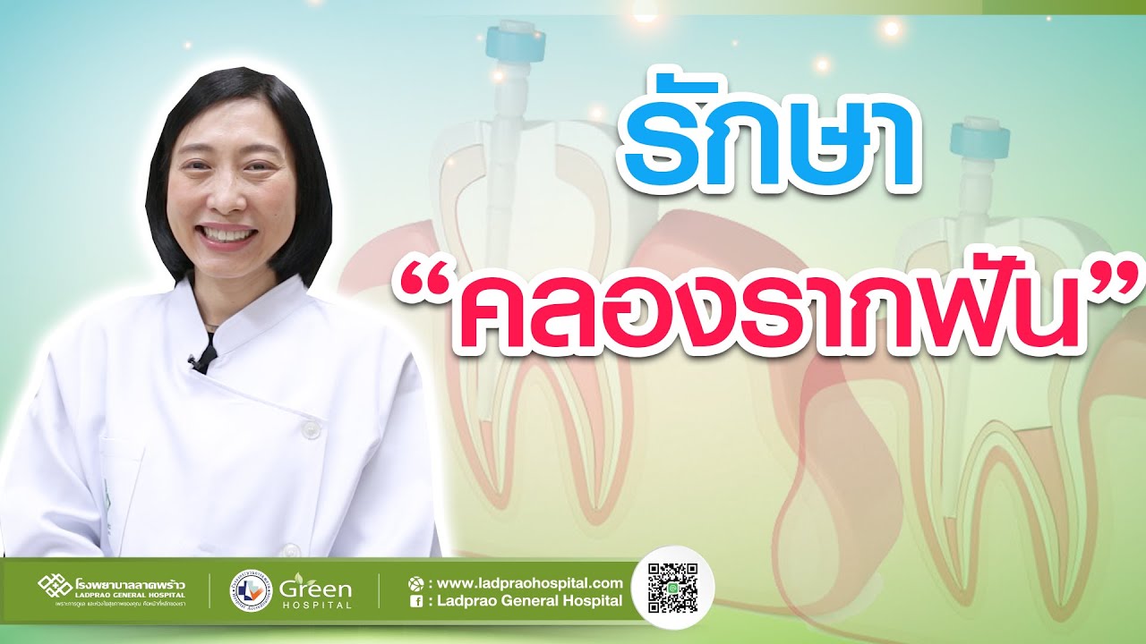 การรักษาคลองรากฟัน