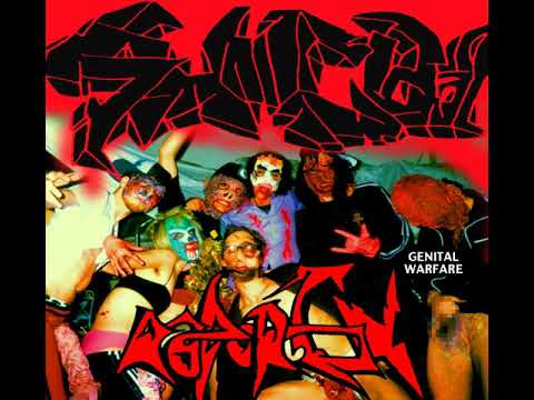 Video thumbnail for Pyogenic Ulcer