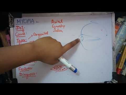 Myopia diagnózisa