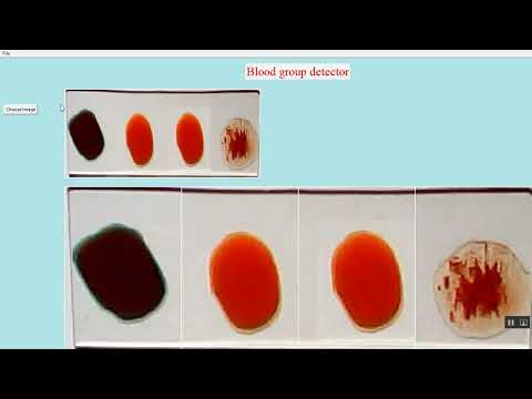 Blood Group Detection in Python Projects