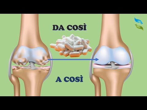 Goodbye ARTHRITIS or CARTILAGE problems with these 4 natural supplements!