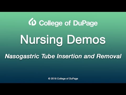 Nasogastric Tube Insertion and Removal