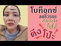 โบท็อก ลดริ้วรอย