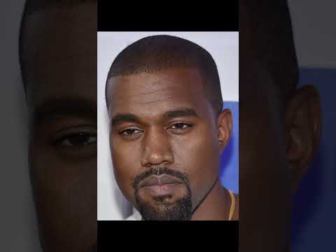 Celebrities BEFORE TheirHair Transplant 😱