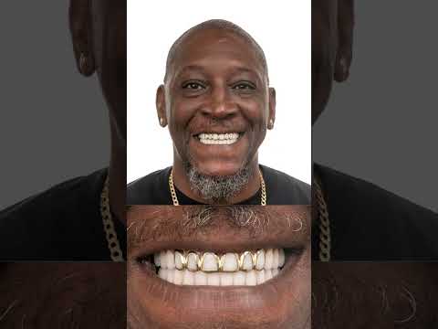 Gold All in My TEETH!