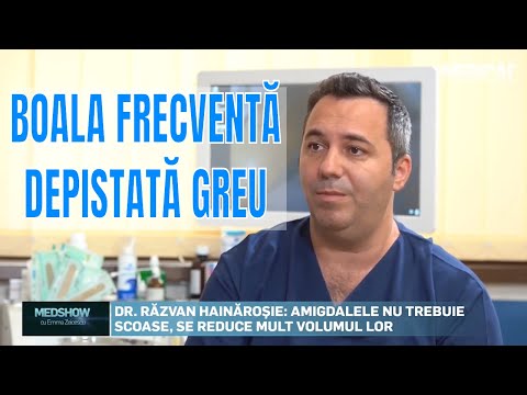 este tratat virusul papilomului uman