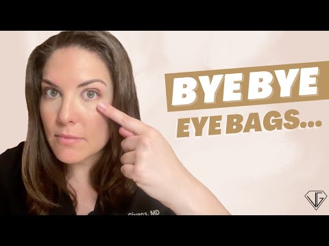 How to QUICKLY Get Rid of Your Eye BAGS For Good