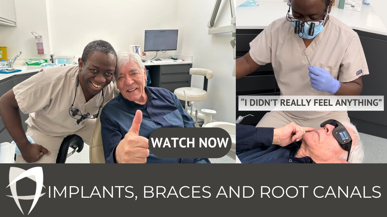 James Hope - All-on-4 (Upper), Fixed Braces (Lower), 5 Implants (Lower Posterior)
