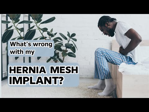 Hernia Mesh Explained | Hernia Mesh Side Effects, Causes, Symptoms | Hernia Mesh Lawsuit #HerniaMesh