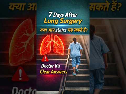 👉 7 Days After Lung Surgery | क्या आप Stairs चढ़ सकते हैं? | Dr Belal Bin Asaf Explains