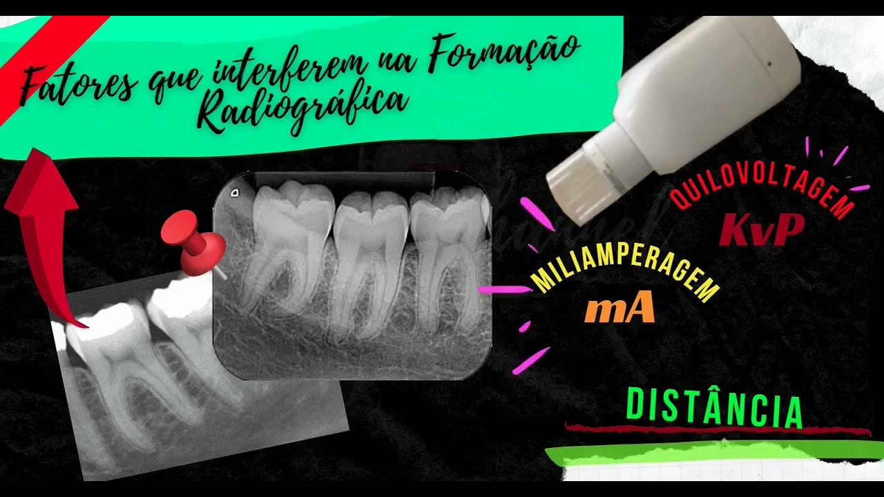 Fatores de Formação Radiográfica (Odontologia)