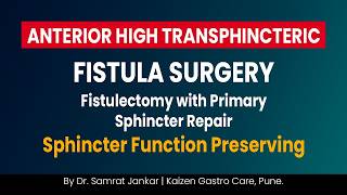 Anterior High Transsphincteric Fistula (Type 3) | Sphincter-Preserving Surgery | Dr. Samrat Jankar