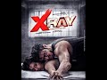 Watch X Ray Inner Image Full Hot Movie In Hindi 2020 ?