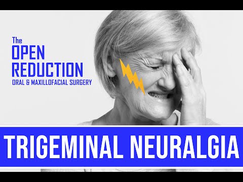 Trigeminal Neuralgia | How To Evaluate And Treat