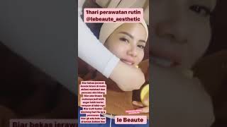 Devi Lanni ( Demplon ) Perawatan Wajah biar Makin Cantik