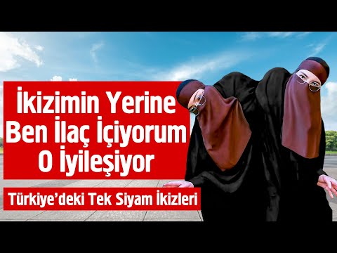 İkizimin Yerine Ben İlaç İçiyorum O İyileşiyor - Siyam İkizleri