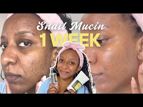 I Tested COSRX Snail Mucin for 7 Days! (results to realistically expect with hyperpigmentation)
