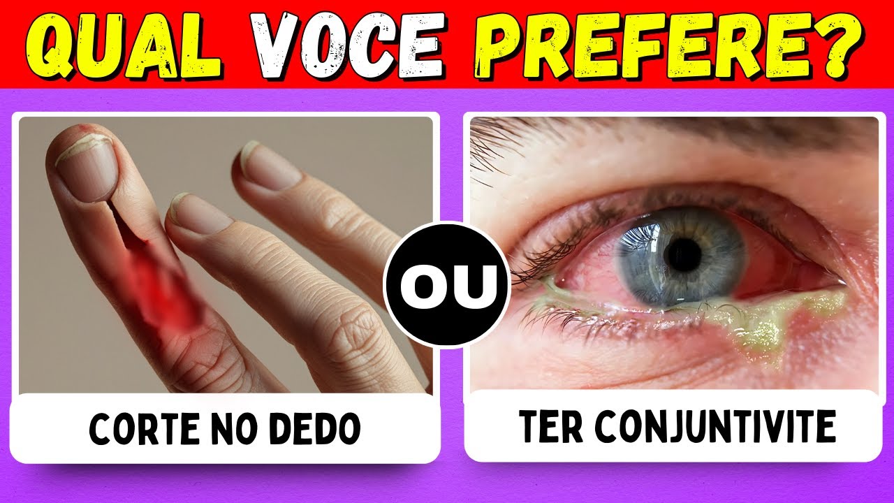 Qual Você preferiria...?  Escolhas mais difíceis de todos os tempos! 😱😨
