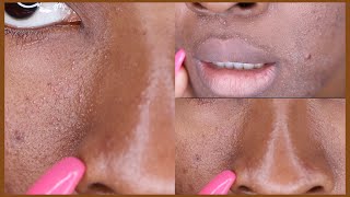 This Neutrogena Product RUINED My Skin 😢