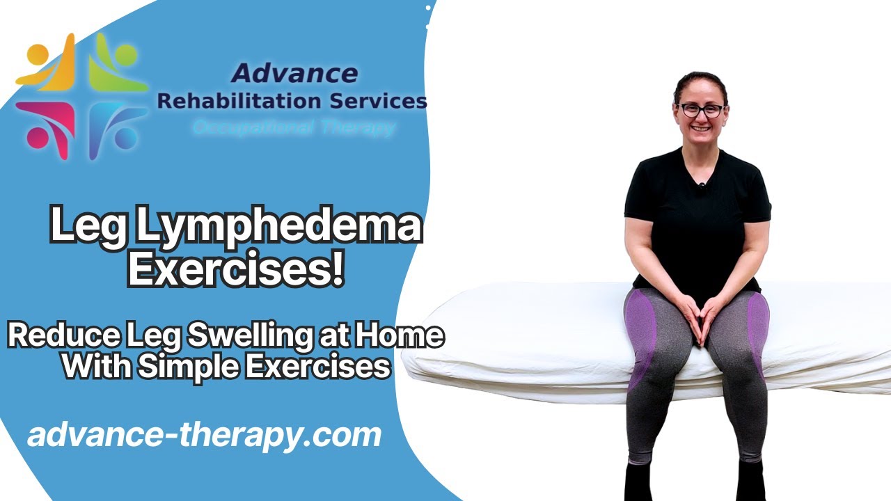 Leg Lymphedema: Exercises to Reduce Swelling