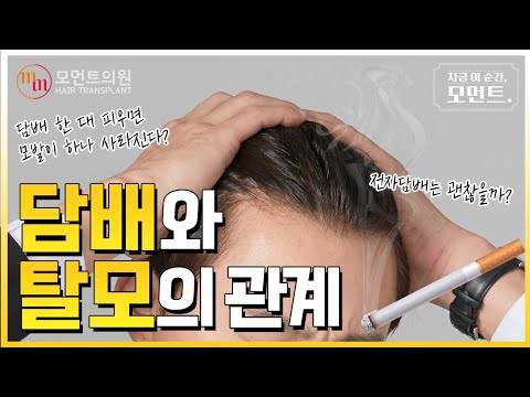 담배와 탈모의 관계 (연초, 전자담배) ???? l 김경복원장 l 모먼트의원(MOMENT)