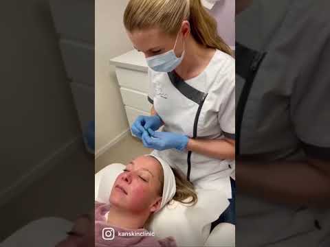 Kan Skin Cllinic Booster behandeling
