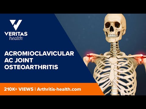 Acromioclavicular AC Joint Osteoarthritis