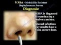 MRSA Methicillin Resistant Saphylococcus Aureus - Everything You Need To Know - Dr. Nabil Ebraheim