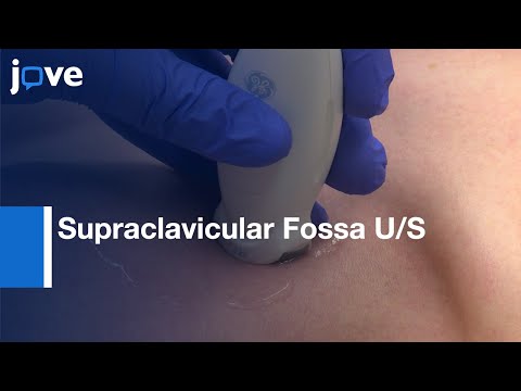 Supraclavicular Fossa U/S: Central Venous Catheter Adjustments | Protocol Preview