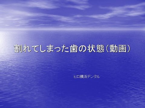 歯学科 ヒロ横浜デンタル　歯の根が割れて抜くことになった箇所に自分の親知らずを移植(No.1)
