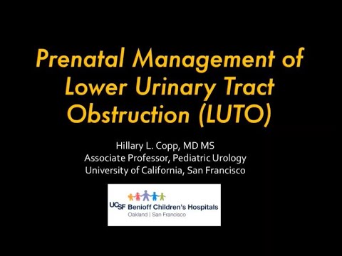 4.14.2020 PedsUroFLO Lecture - Prenatal Management of LUTO