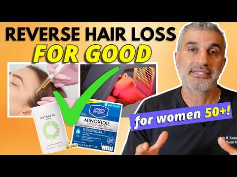 Hair Loss for Women over 50, what ACTUALLY works??