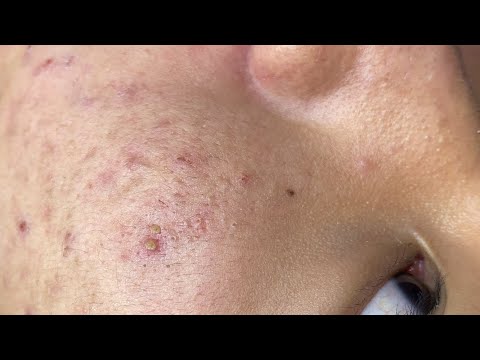 Relax Every Day SacDepSpa #884