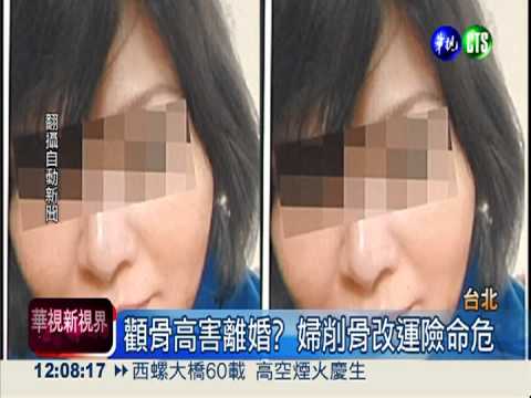 失婚婦削骨改運 顱內出血險送命