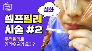필러 절대 맞으면 안되는 3가지 부위 | 필러 부작용, 종류, 후기 + 추천 부위