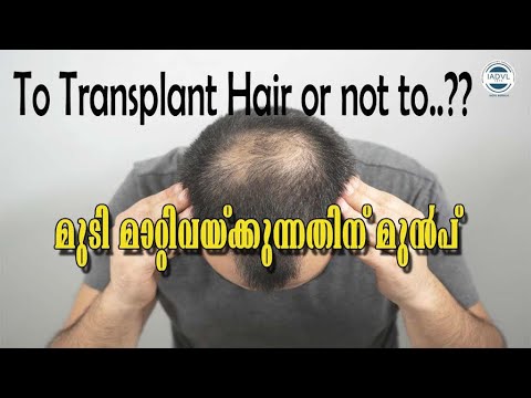 Hair Transplantation (മുടി മാറ്റിവയ്ക്കൽ)