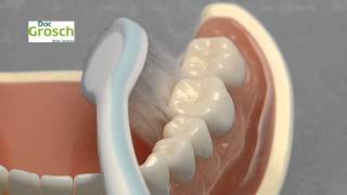 preview picture of video 'Tipps zur Zahnpflege bei Zahnfleischentzündungen - Zahnarzt Coburg'