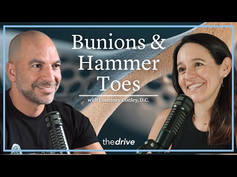 @PeterAttiaMD - "Bunions & Hammer Toes: Causes, Symptoms, & Solutions | Courtney Conley, D.C."