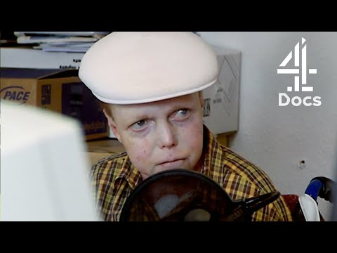 The Boy Whose Skin Fell Off