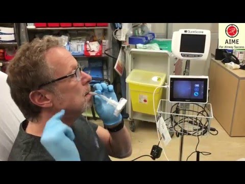 Aerosolized lidocaine for topicalizing the airway