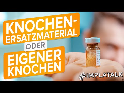 Eigenknochen vs. Knochenersatzmaterial - Was funktioniert besser in der Implantologie?