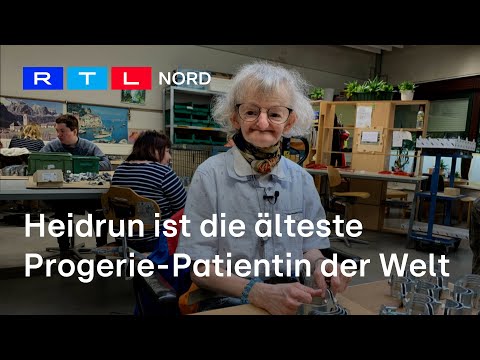 Progerie-Patientin Heidrun ist ein medizinisches Wunder