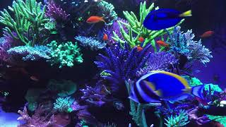 10 Hours of Relaxation, Spa, Study, and Meditation with Our Tropical Aquarium Fish Tank Screensaver!