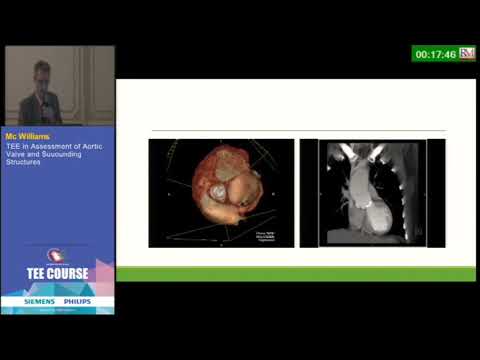TEE in Assessment of Aortic Valve and Surrounding Structures