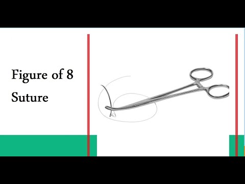 Figure of 8 Suture