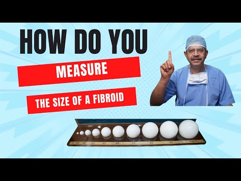 How do you measure  the size of a fibroid?
