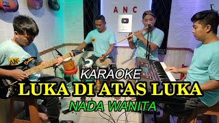 Download lagu LUKA DI ATAS LUKA KARAOKE NADA WANITA mp3 Download lagu LUKA DI ATAS LUKA KARAOKE NADA WANITA mp3