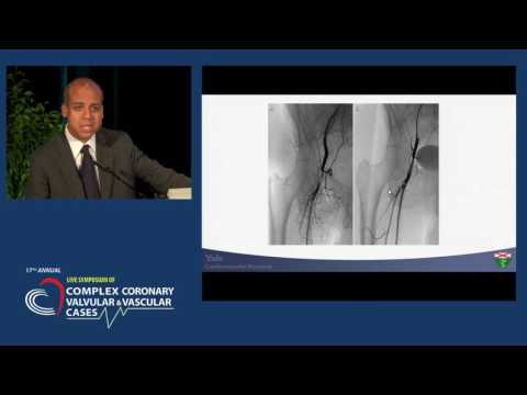 Endovascular Therapy for Managing Common and Profunda Femoral Artery Occlusive Disease