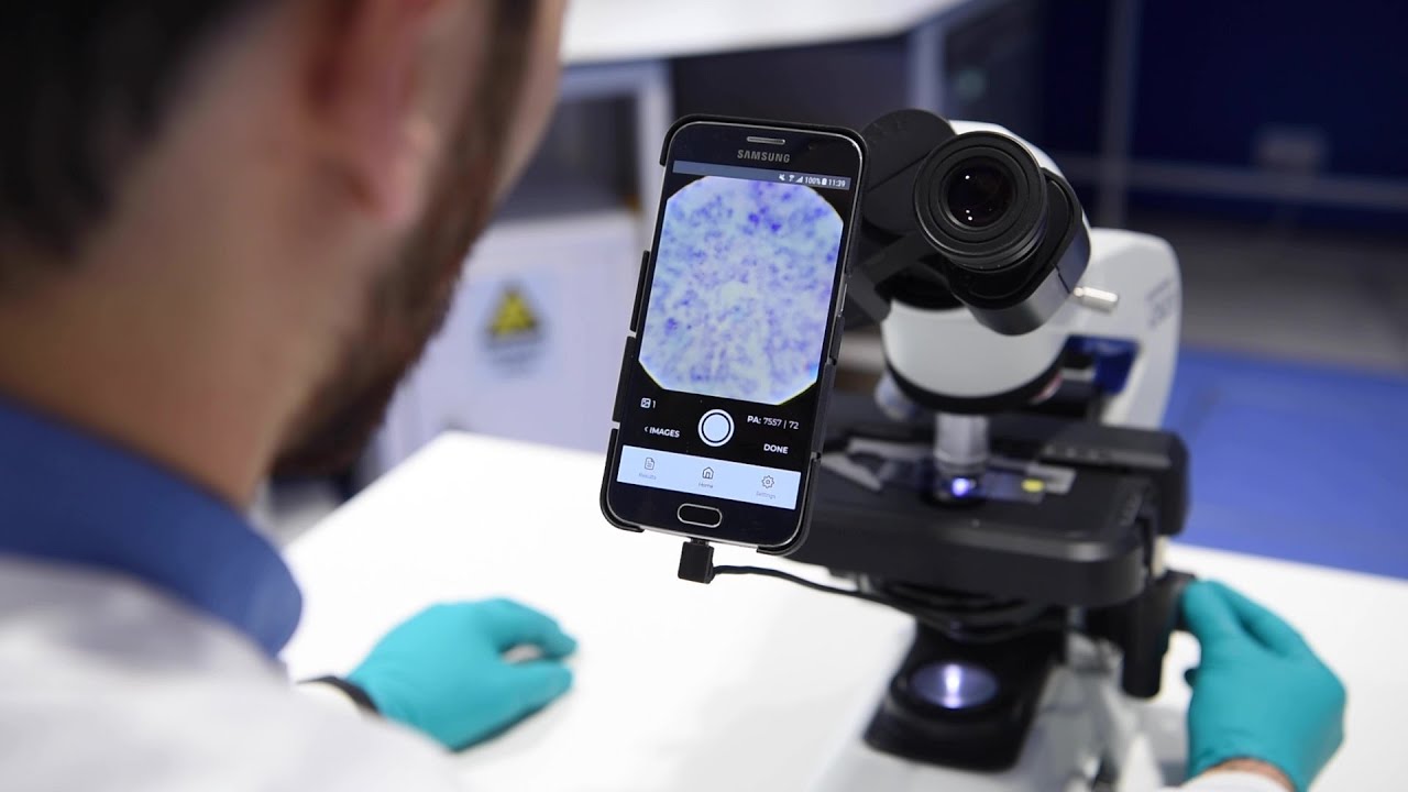 Improving Tuberculosis Monitoring with Deep Learning