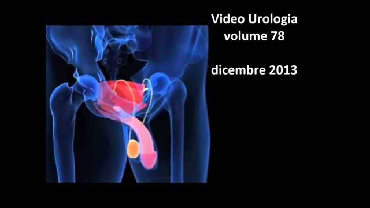 Ecocolordoppler basale e dinamico del pene o dei corpi cavernosi Roma. Rieti Viterbo